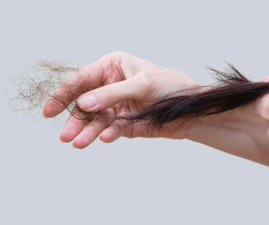 Rụng Hơn 100 Sợi Mỗi Ngày